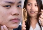 Hair Fall in 20s: 20 की उम्र में ही क्यों झड़ने लगे हैं बाल? बढ़ता हेयर फॉल बना चिंता, जानें कारण और बचाव के तरीके