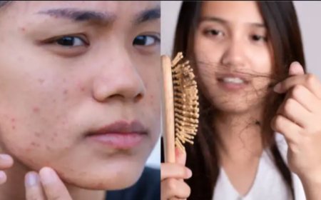 Hair Fall in 20s: 20 की उम्र में ही क्यों झड़ने लगे हैं बाल? बढ़ता हेयर फॉल बना चिंता, जानें कारण और बचाव के तरीके