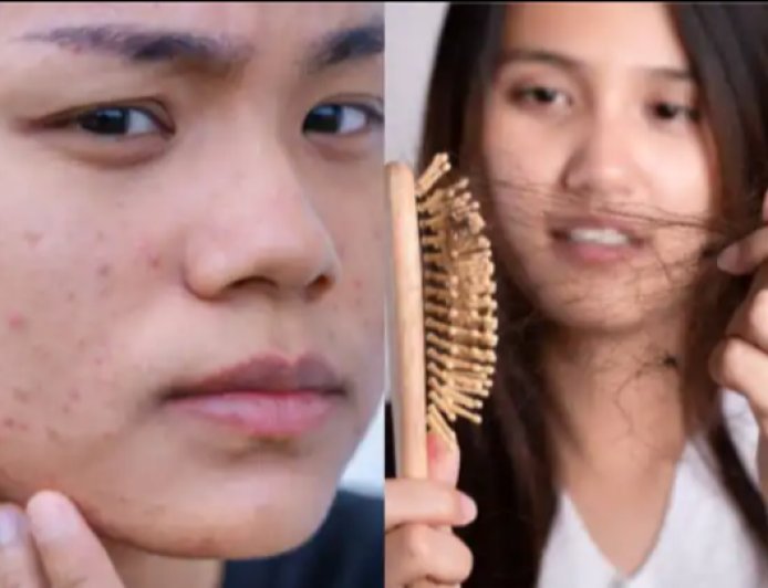 Hair Fall in 20s: 20 की उम्र में ही क्यों झड़ने लगे हैं बाल? बढ़ता हेयर फॉल बना चिंता, जानें कारण और बचाव के तरीके