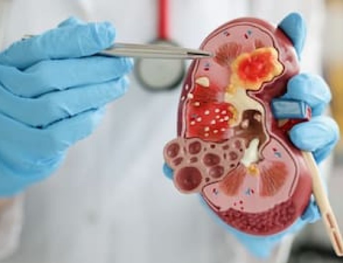 Kidney Disease Symptoms: किडनी फेलियर के चेतावनी संकेत: पैर में सूजन से लेकर बेहोशी तक,यहां देखिए लक्षण और उपाय