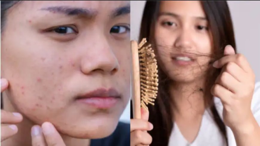Hair Fall in 20s: 20 की उम्र में ही क्यों झड़ने लगे हैं बाल? बढ़ता हेयर फॉल बना चिंता, जानें कारण और बचाव के तरीके