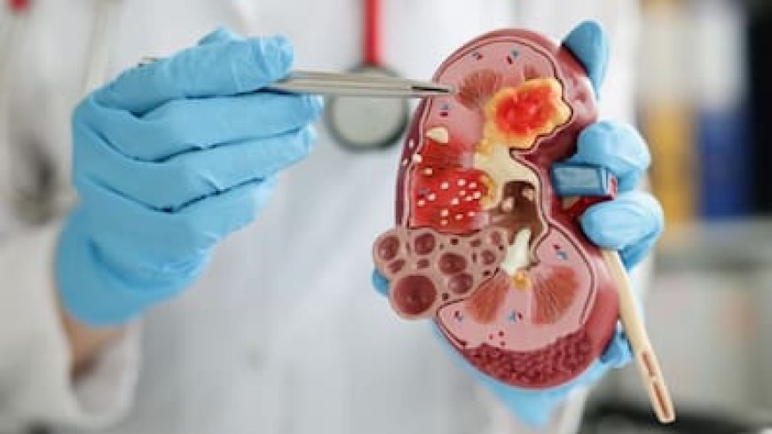 Kidney Disease Symptoms: किडनी फेलियर के चेतावनी संकेत: पैर में सूजन से लेकर बेहोशी तक,यहां देखिए लक्षण और उपाय