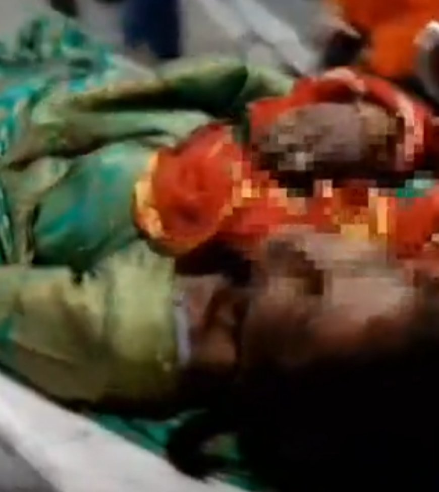 MP News: भगवान श्रीराम के नाम पर पति बना हैवान, पत्नी से बोला- राम नहीं महाकाल के वीडियो देखो, झगड़े में तलवार से किया हमला,महिला घायल